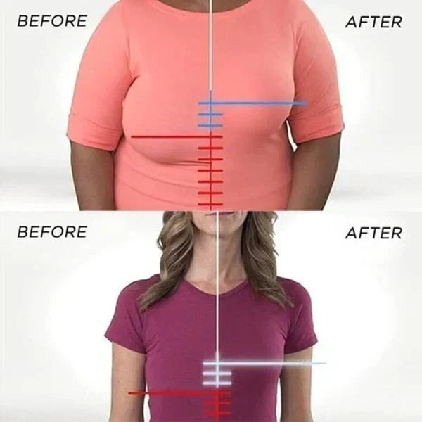 FRONT CLOSURE ACUTEFEBRUARY BRA(BUY 1 FREE 2)